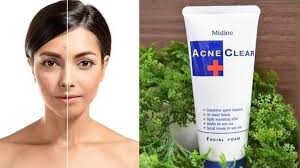 Mistine Acne Clear Facial Cleansing Foam Effectively Clean Your Face with 5 Valuable Ingredients and Your face Will Noticeably Cleaner and Visibly Clearer From Acne.